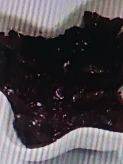 中风偏瘫，手脚麻木，一个中药中成药痰湿拔除经络，疏通痛，疼痛消失