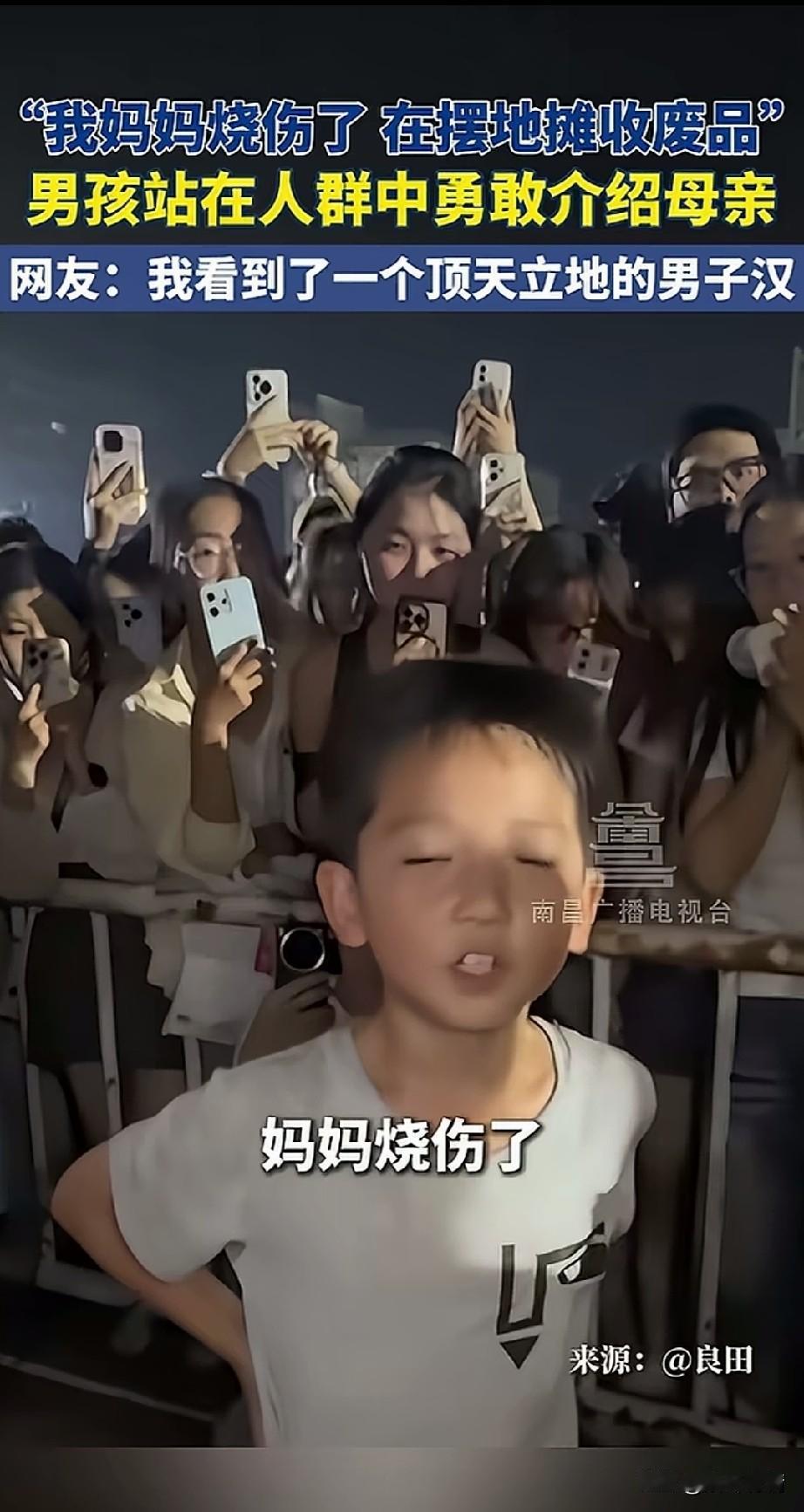 河南郑州一小孩和自己烧伤的妈妈，
在大学城附近摆摊卖拖鞋，
妈妈本来想带着他看踢