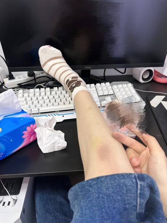 今天算是发现了未婚未育唯一的一个坏处，那就是在公司搞活动时，咱所有没孩...