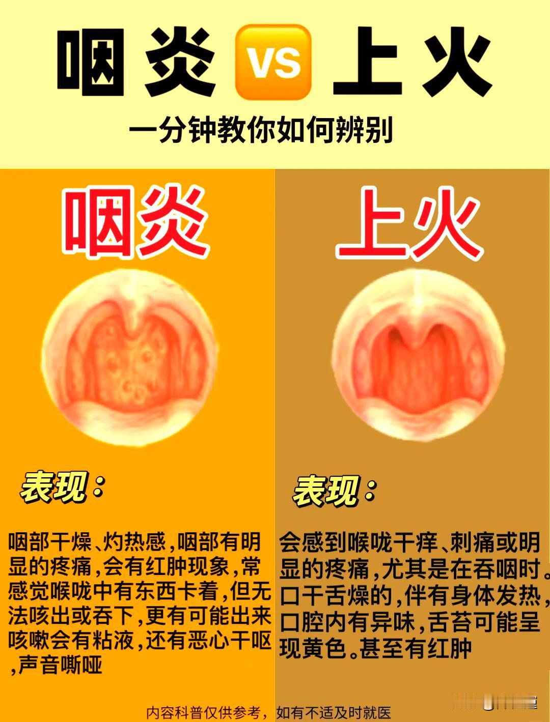 入秋急性咽炎扎堆爆发！嗓子又干又痛，很多人第一步就做错
 
 入秋之后，昼夜温差