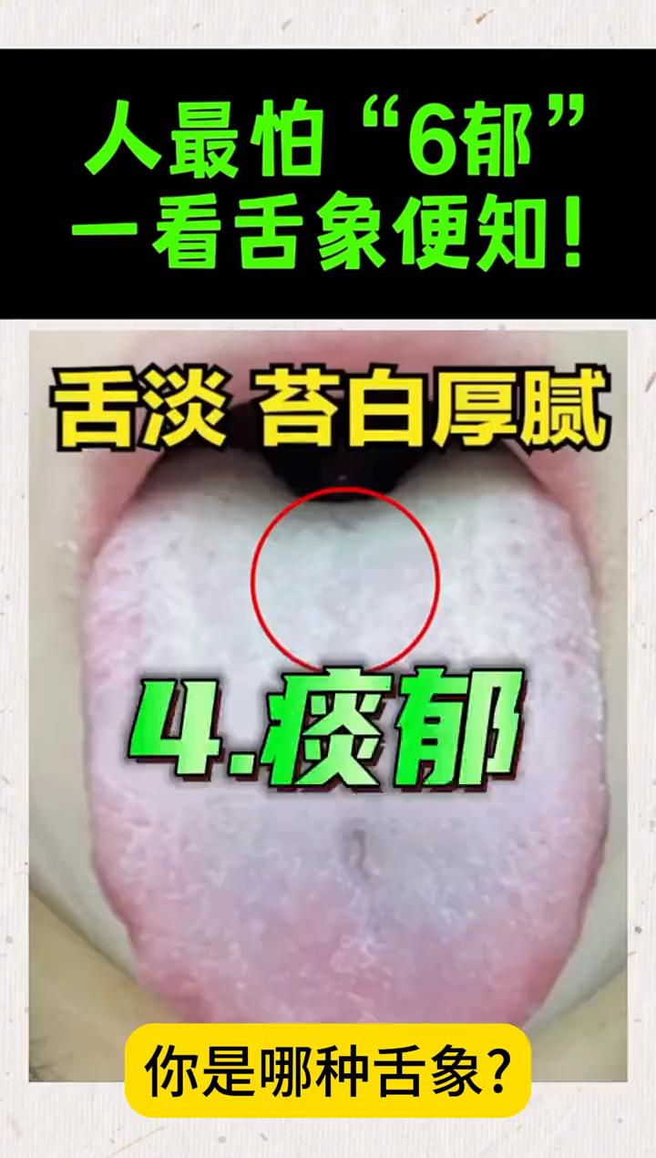 人最怕"6郁"，一看舌象便知！
人有六郁：肝郁、食郁、失郁、痰郁、火郁、血郁。你