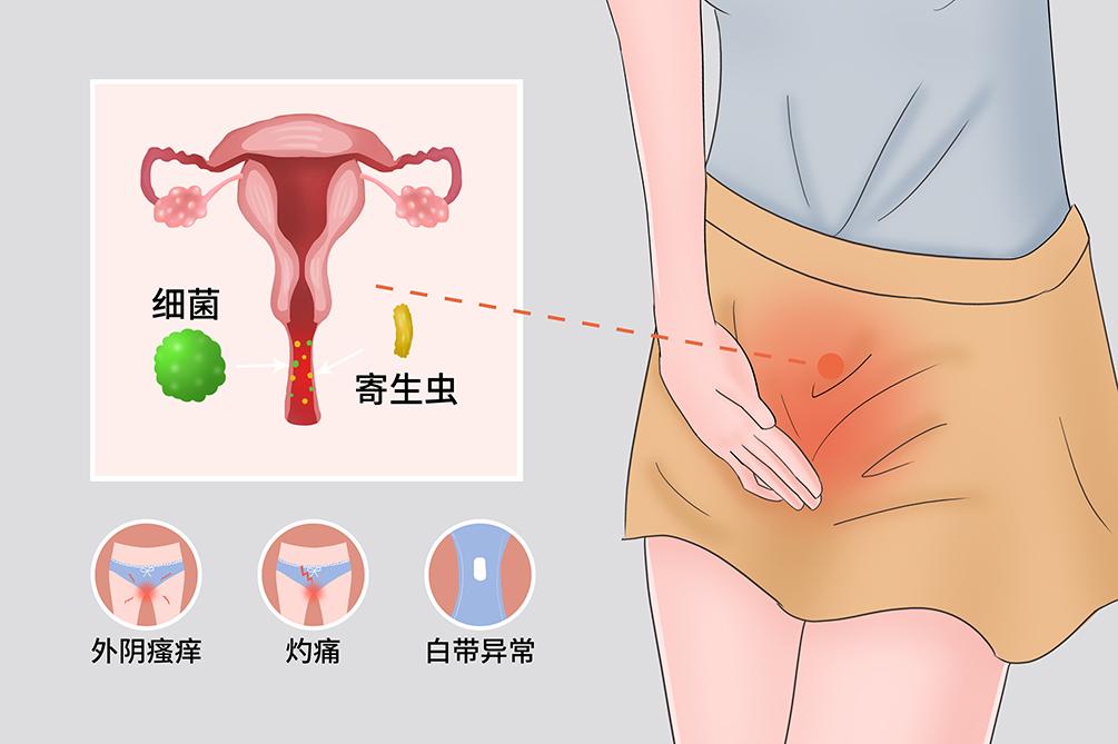 #健康真探社#【这4件事最糟蹋阴道！你中招了吗？】阴道是女性重要的生殖器官，而阴