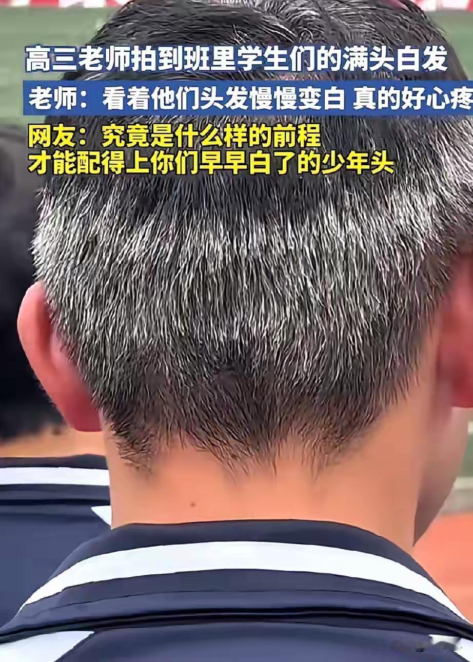 高三学生头发花白，是压力太大？

看到一位网友发的高三男生满头花白头发，心理真的