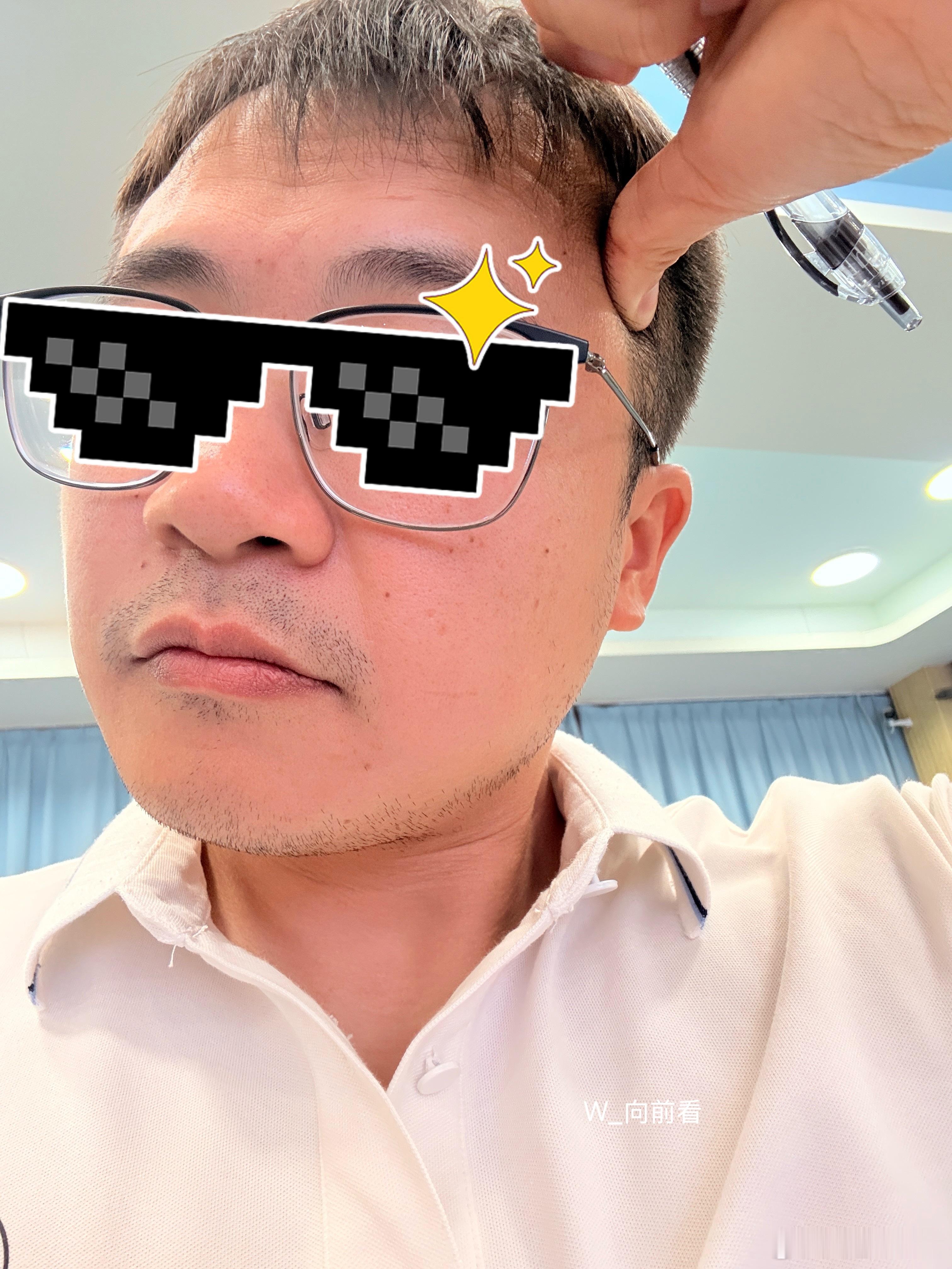 1点半开始培训，现在头Fa Fa 声！[笑cry][笑cry]需要人帮忙按按！[