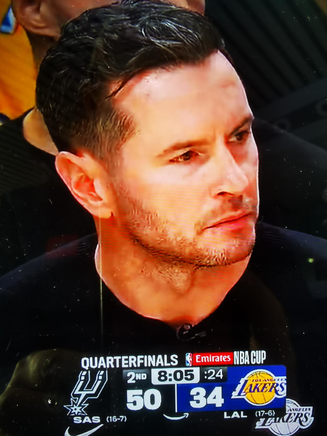 难以抉择的雷迪克

        湖人119-132，主场输给马刺。最近5场，