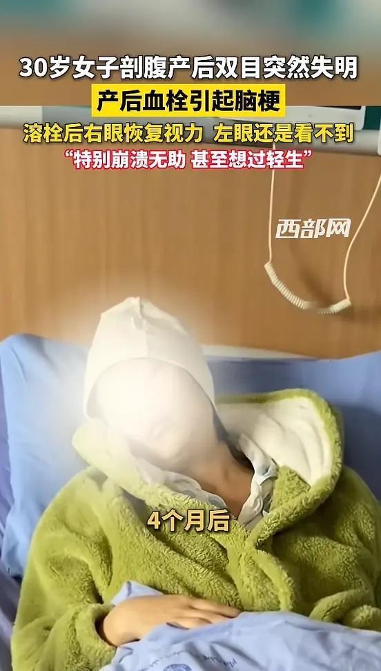 “太吓人了！”4月28日报道，贵州六盘水，一30岁女子剖腹产后，双眼突然失明，检