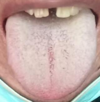 海绵体尺寸缩水，根源是寒湿困阳





有不少朋友出现了海绵体柔韧性太差的问题