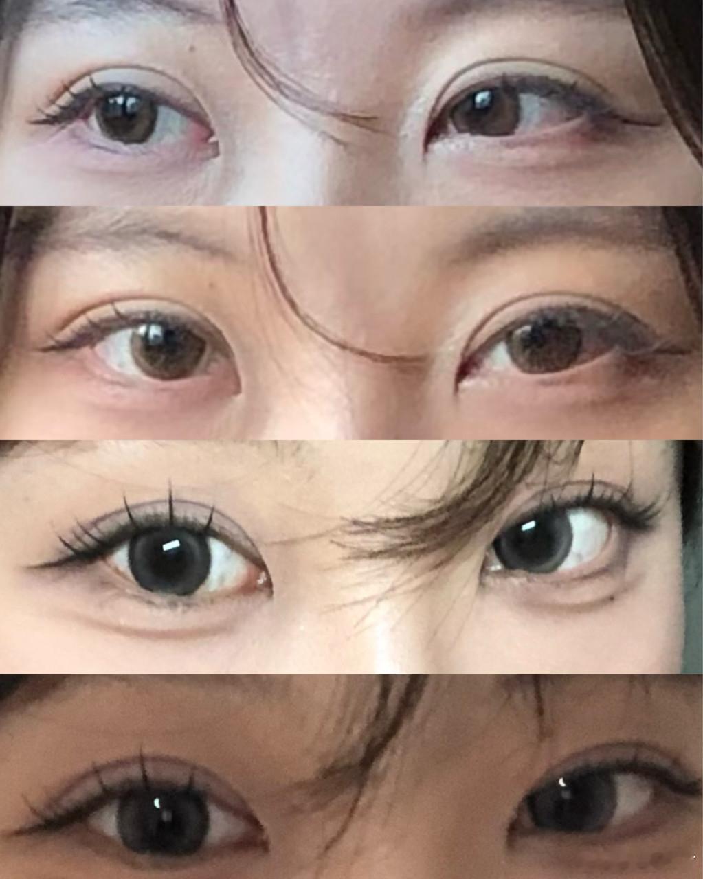 整形这个东西真的要认命的，要看运气的，不是说功课到位胜算就高（但凡你看的医生不是