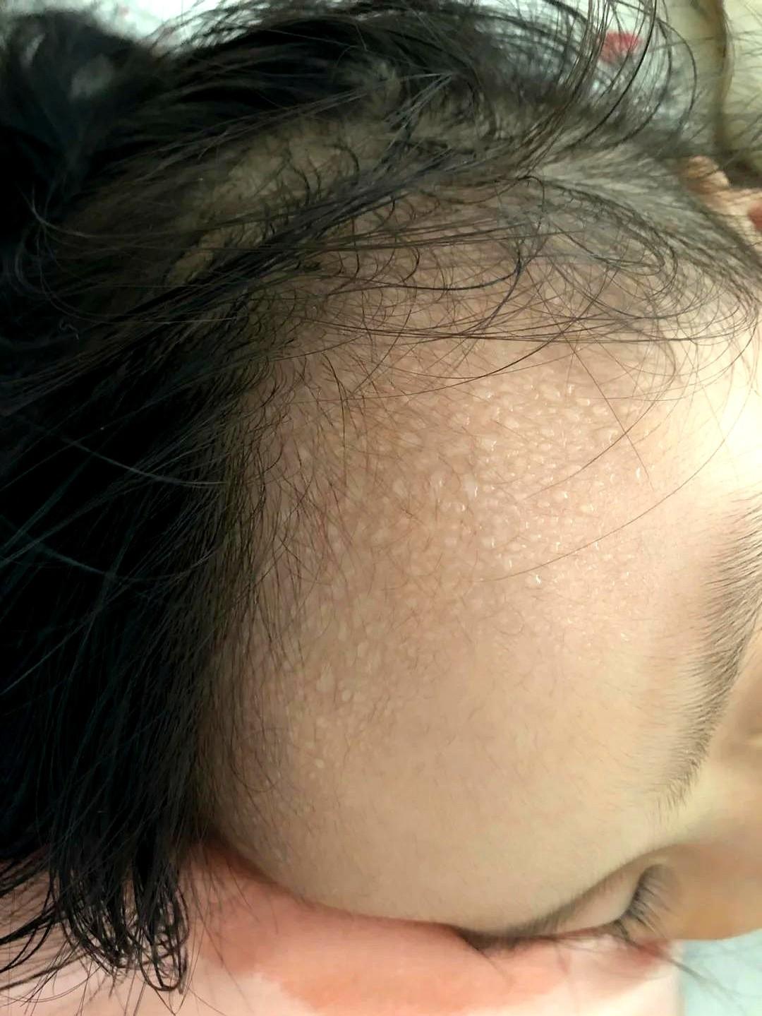 “孩子整夜汗湿枕头，家长还在等自愈？”
空调开到23℃像冷藏室，娃的刘海还能拧出
