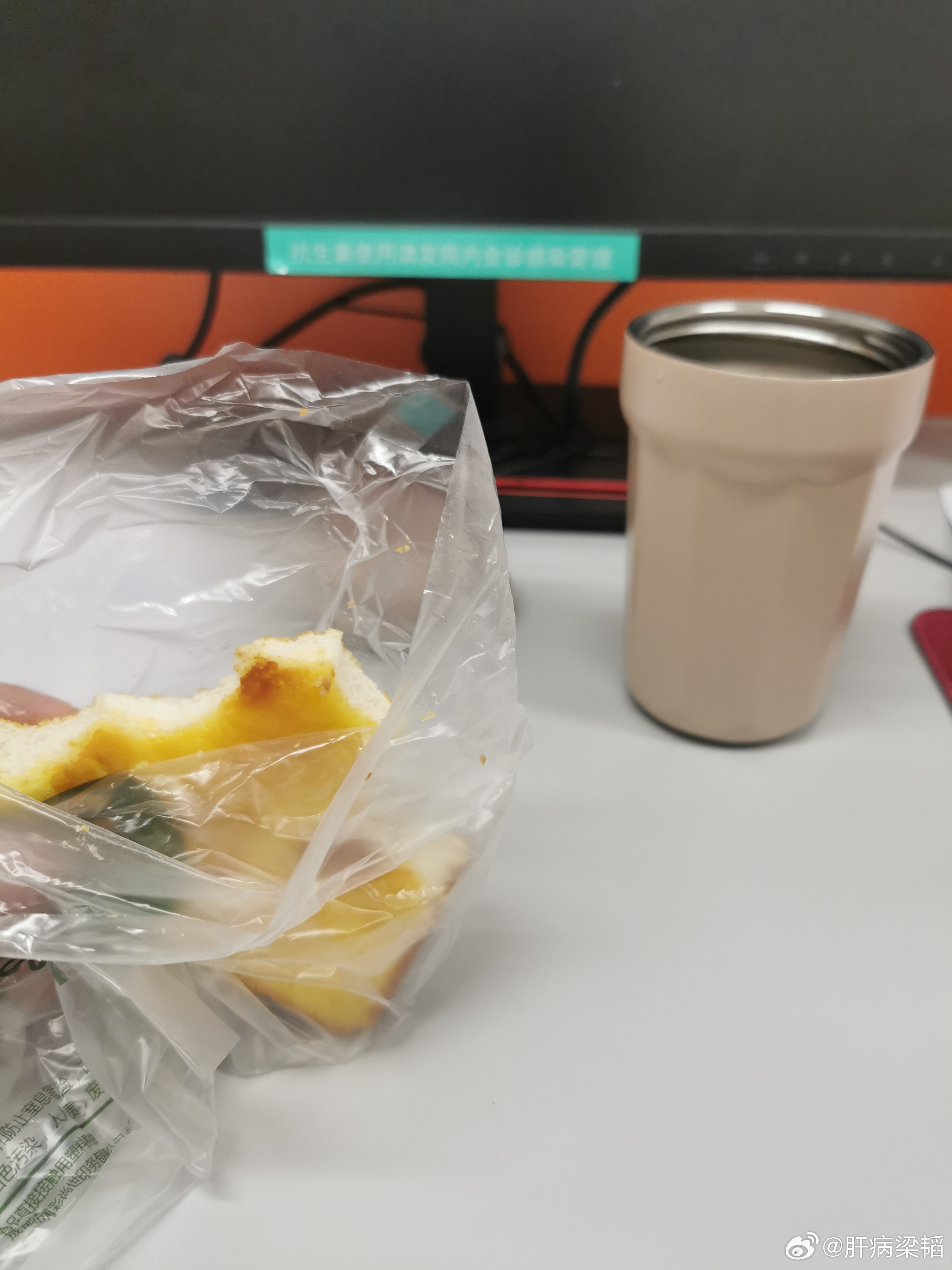 最近连续加班到深夜。抵制内卷文化，建议从医院开始。又去了一趟手术室。AI再猛，能