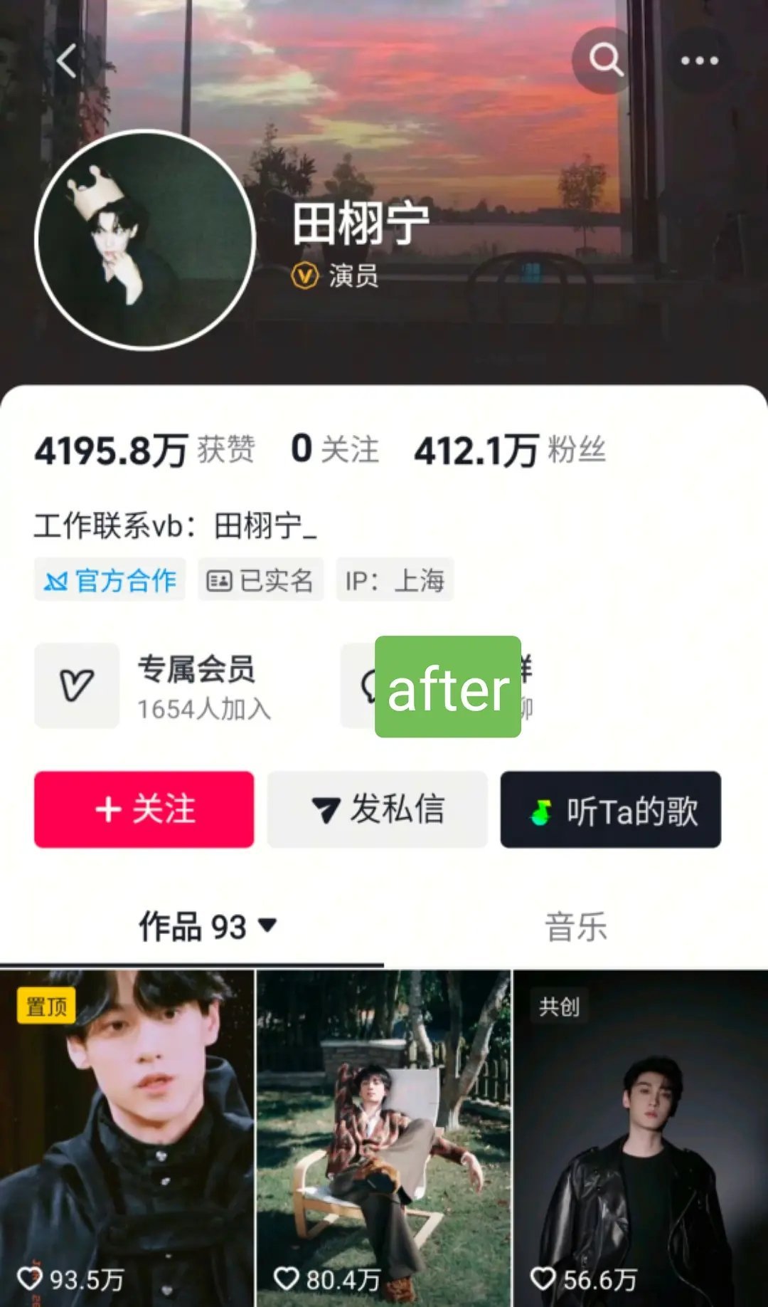 田栩宁竟然掉了这么多粉 