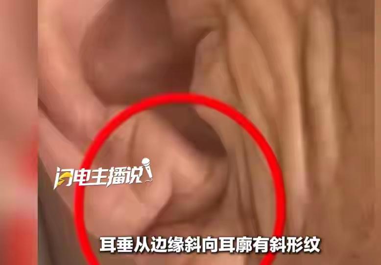 这医生，真的是救命的活菩萨[赞][赞]
近日，江苏南京
一名70多岁的男子，老伴