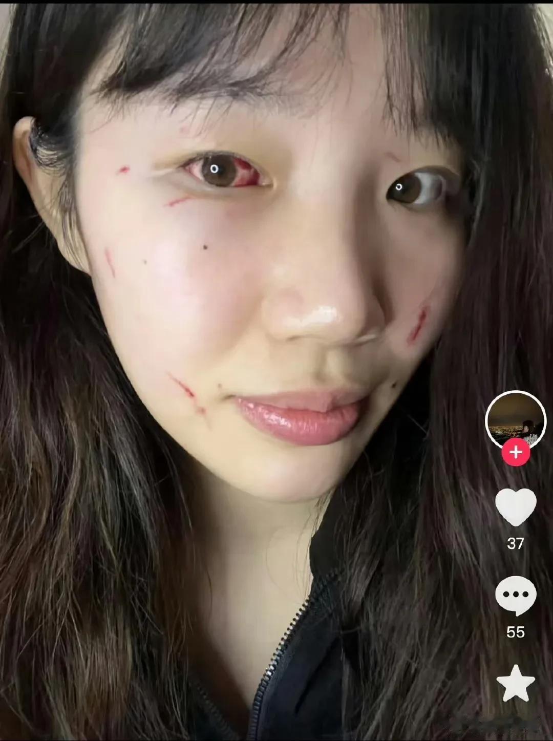 恐怖！北京女篮球员面部遭对手抓伤！

据媒体人宋翔透露，北京首钢首侨女篮中锋刘晶