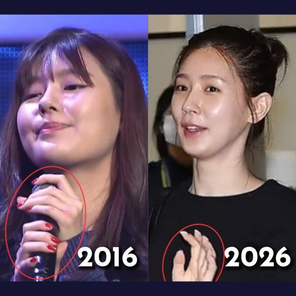 🧩赵美延出道前后的手指粗细都没变，就从嫩牛五方的大饼脸突变成上重下轻的锥子脸了