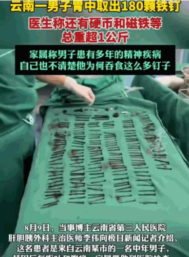 解释不清了！云南，一男子腹部剧痛送医，医生检查后当场被吓退三分：他体内居然塞满了