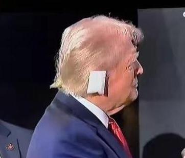 特朗普的耳朵应该多听听民意了
特朗普的耳朵真是“命硬”，刚把右耳的伤养好，枪声又