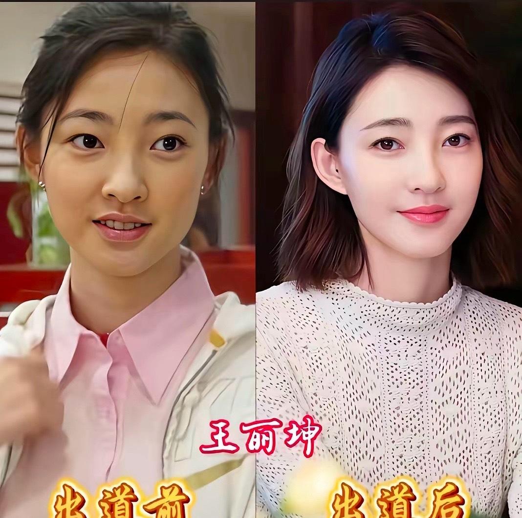 王丽坤：你皮肤怎么一点没变？
张馨予：底子好，也靠养。
张雨绮：出道前明明更青涩