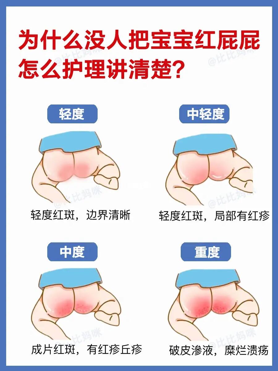 为什么没人把宝宝红屁屁一次性讲清楚❗️