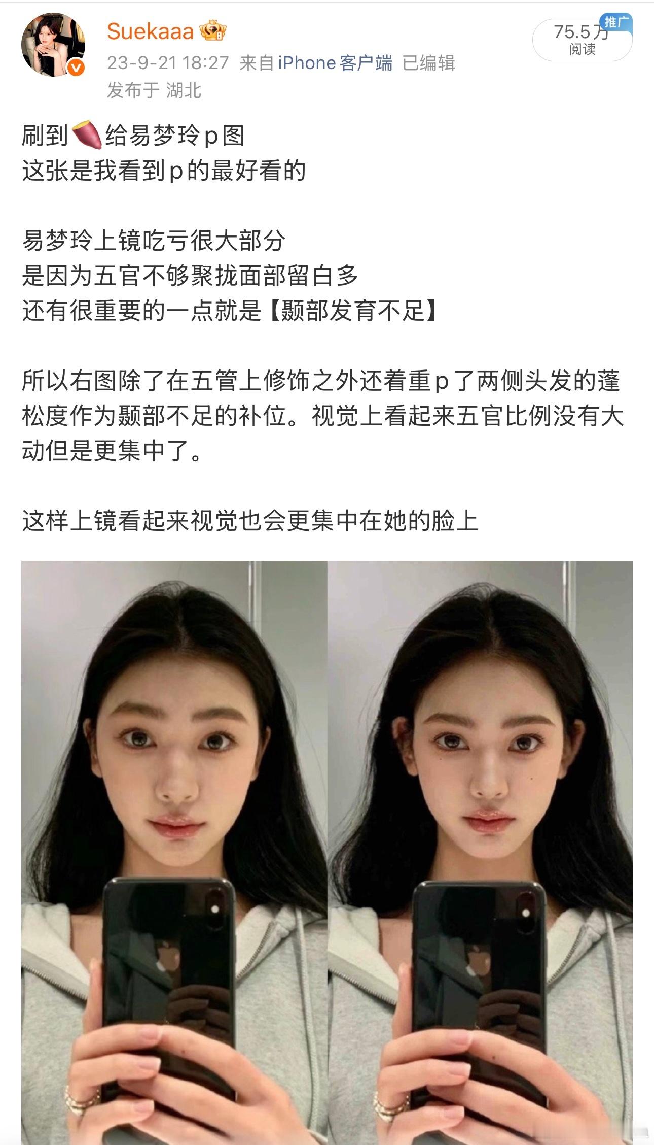 突然翻到之前分享在🍠易梦玲模拟p图再次感叹颞部饱满+适当耳朵外展的重要性整个头