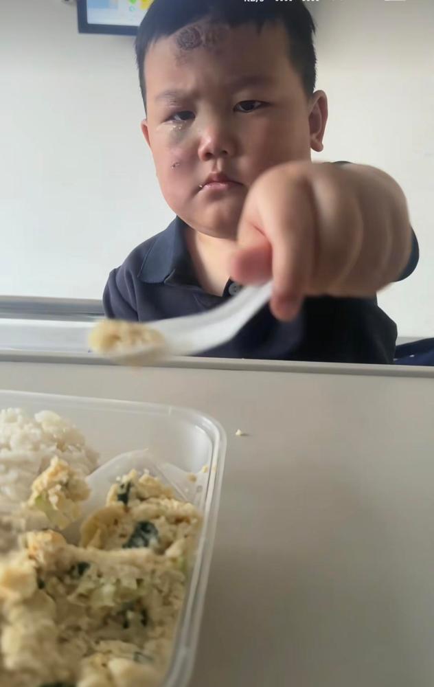 这母子真是过命的交情！

真的看得人鼻头发酸，3岁的娃自己都摔得鼻青脸肿、头缠纱