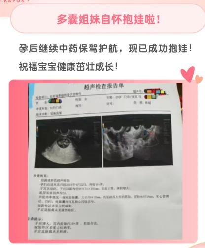 👉姐妹多囊病史7年，外院促排后曾自怀顺产1胎，后两次不良妊娠，外院调理5年，仍