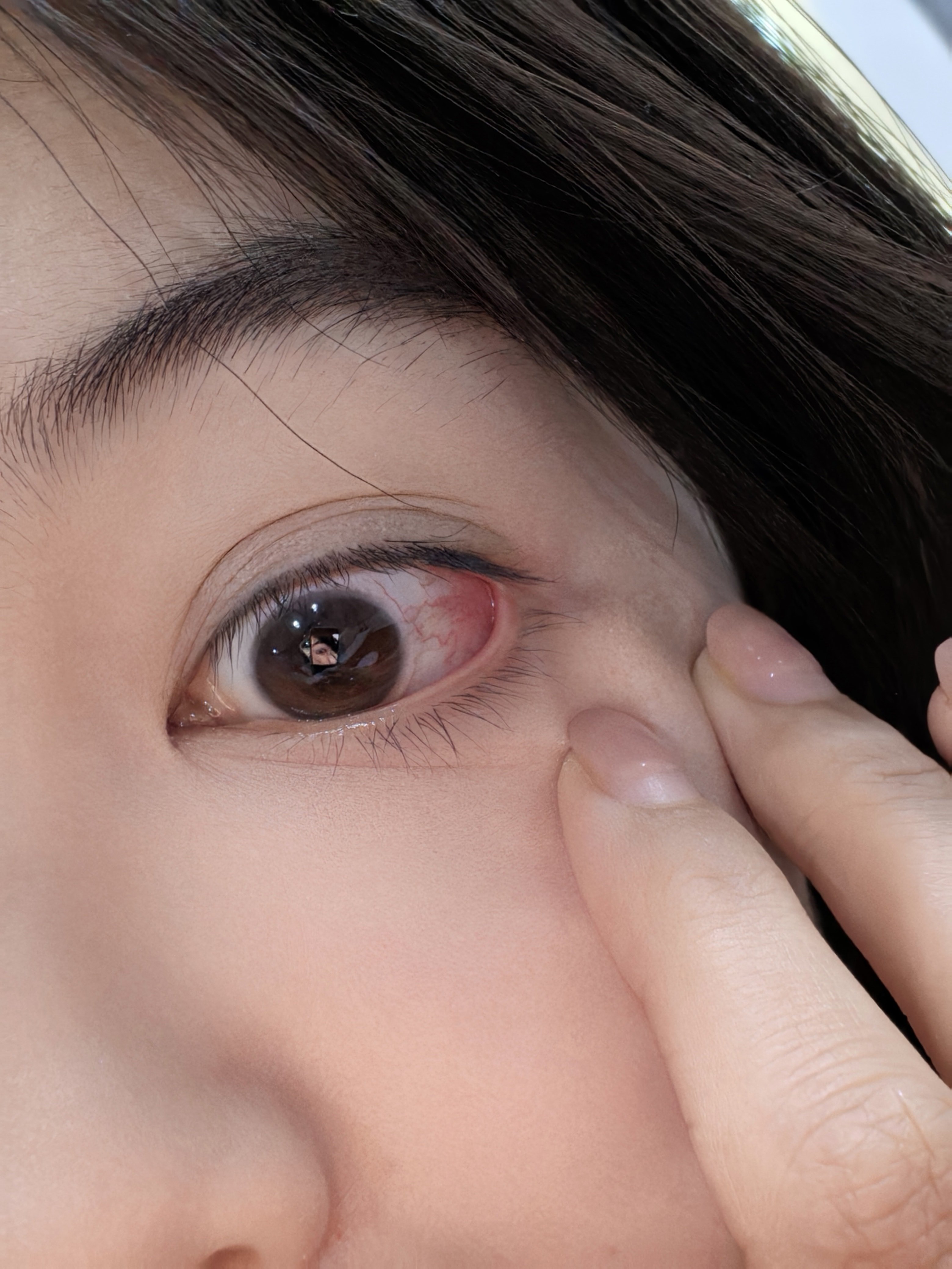 ⁠感觉不知道又什么过敏了，这一天天的，眼睛超级难受！干什么都很心酸，是真的"酸"