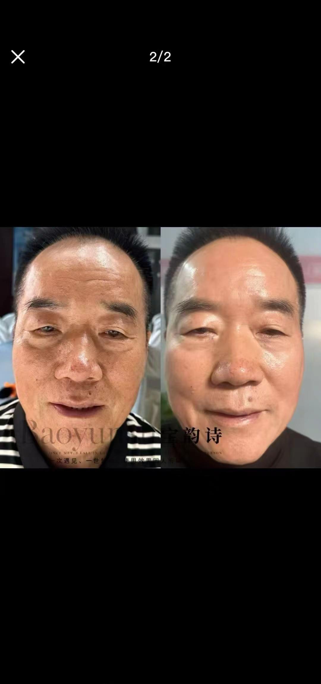 素颜不用遮，皮肤自己会发光。
宝韵诗不靠滤镜，靠的是老祖宗的“清调补养”四步法。