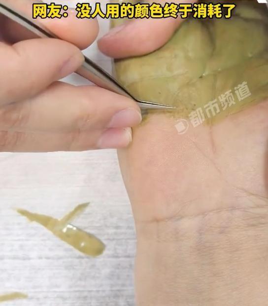 这是真聪明！浙江，一女生双手被玻璃纤维扎到，可她既没有自己拔，没有去医院，而是走