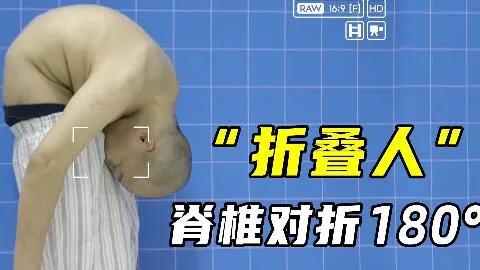 明明是弯的，怎么说是“强直”呢？
一直不理解，脊柱弯成折叠人，在医学上却被说成“