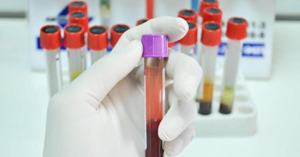 48岁男子饭后昏倒，3天后去世，医生怒斥：这3种食物不要一直吃！ 
 
饭后突然