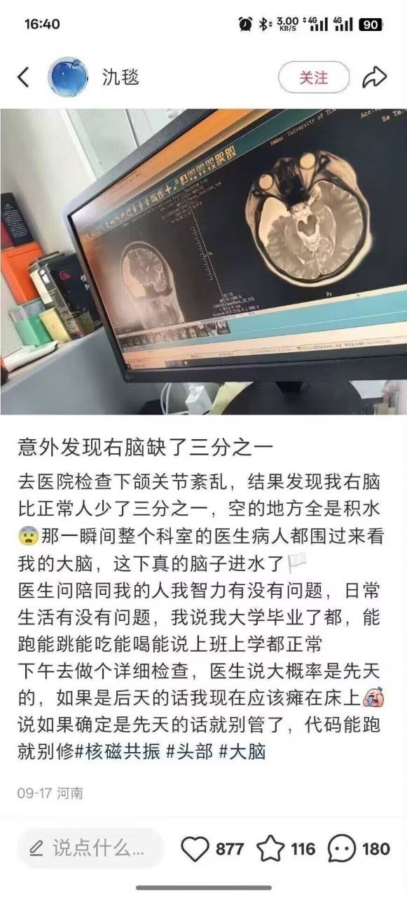大脑有强大的代偿功能，我看过一个极限的案例，脑子只剩十分之一，还能正常生活工作 
