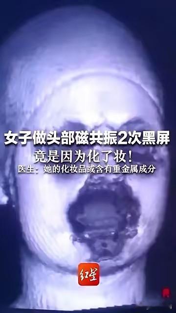 一张脸逼停几百万的核磁共振仪，这乍一听有点夸张，但背后反映的是核磁共振仪曾经的天