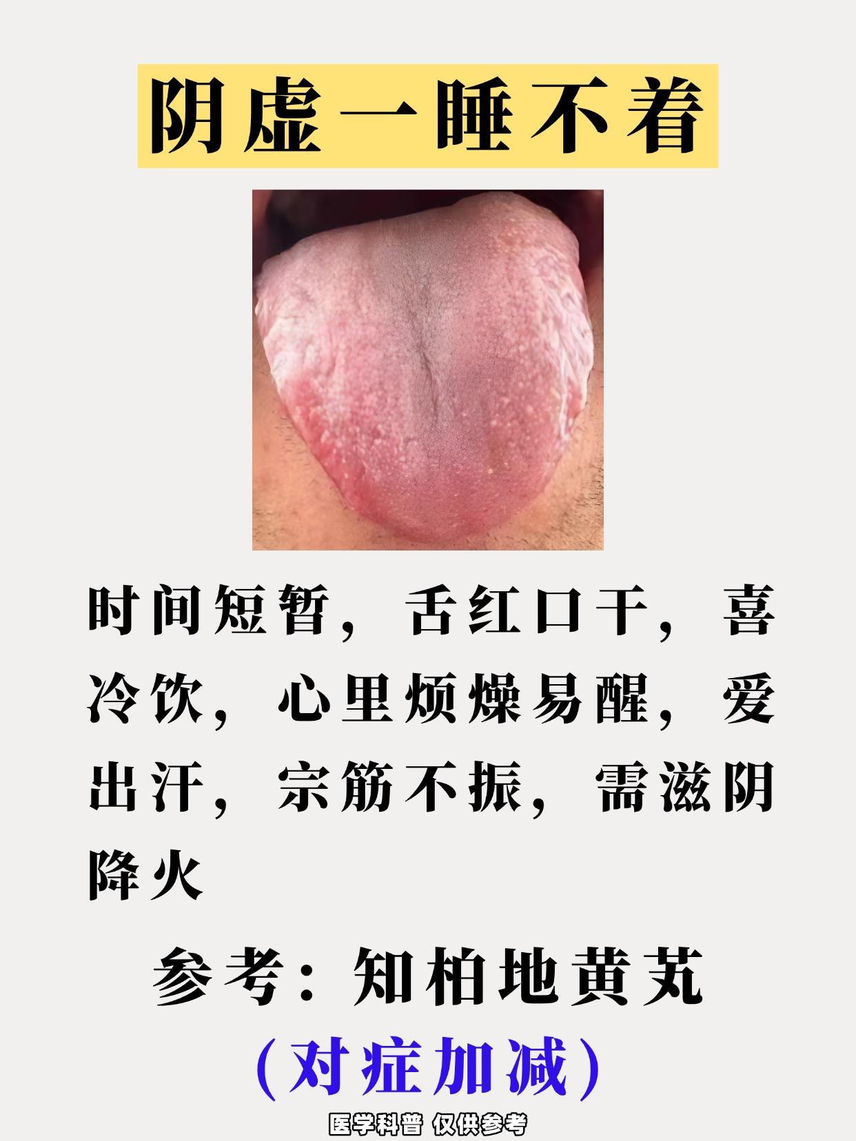 阴虚——睡不着，阳虚——爱睡觉，气虚——睡眠浅，血燥——皮肤痒，血虚——头晕，血
