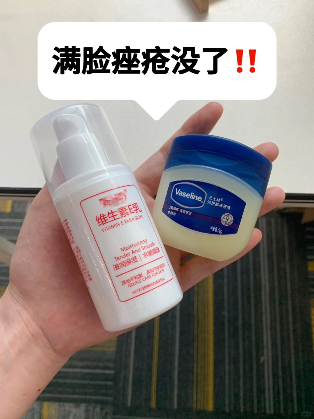 国货牛！重度皮肤痤疮上岸，能帮一个是一个