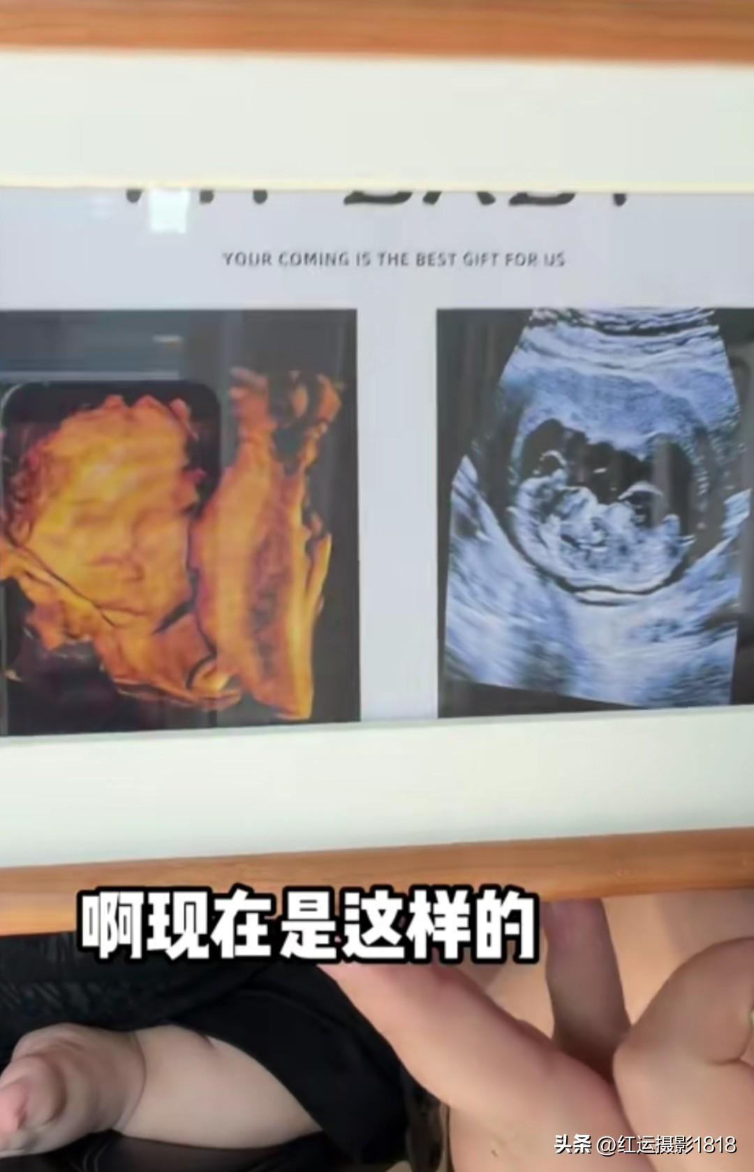 李喜梅和大双今天分享了一件喜讯，喜梅的四维彩超已经做完了，结果显示各个地方都非常