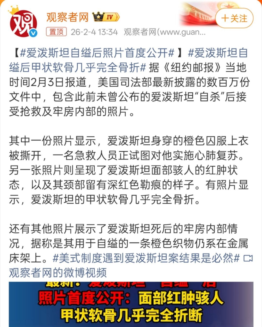 爱泼斯坦自缢后甲状软骨几乎完全骨折好莱坞电影里面杀手杀人那可是各种风骚走位，各种