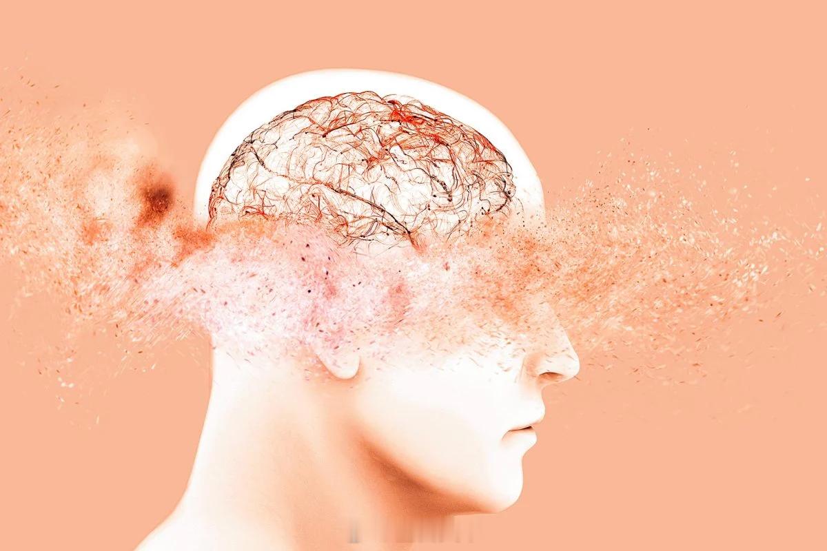 另一长期被忽视的神经退行性疾病参与认知衰退人格改变和行为失控的痴呆症 研究人员最