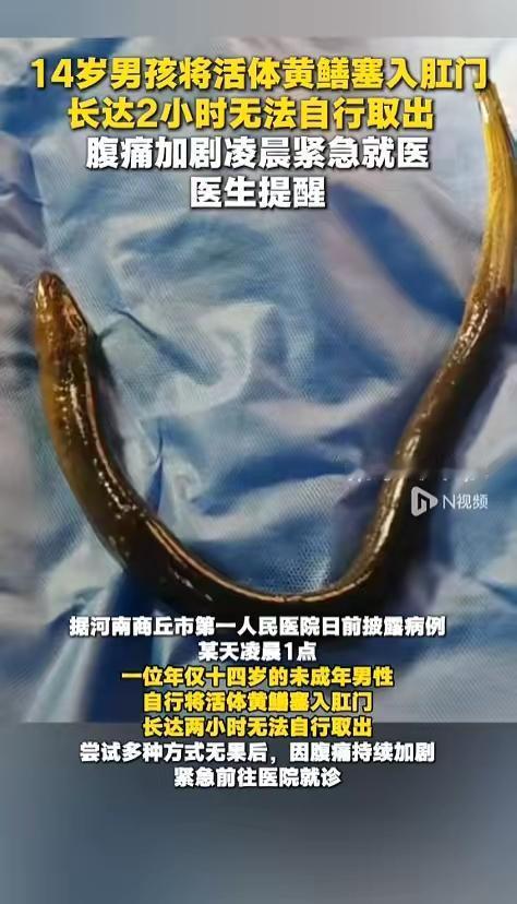 5月25日报道，河南商丘，一位14岁的男孩凌晨到医院就诊，原因竟然体内塞了条活的