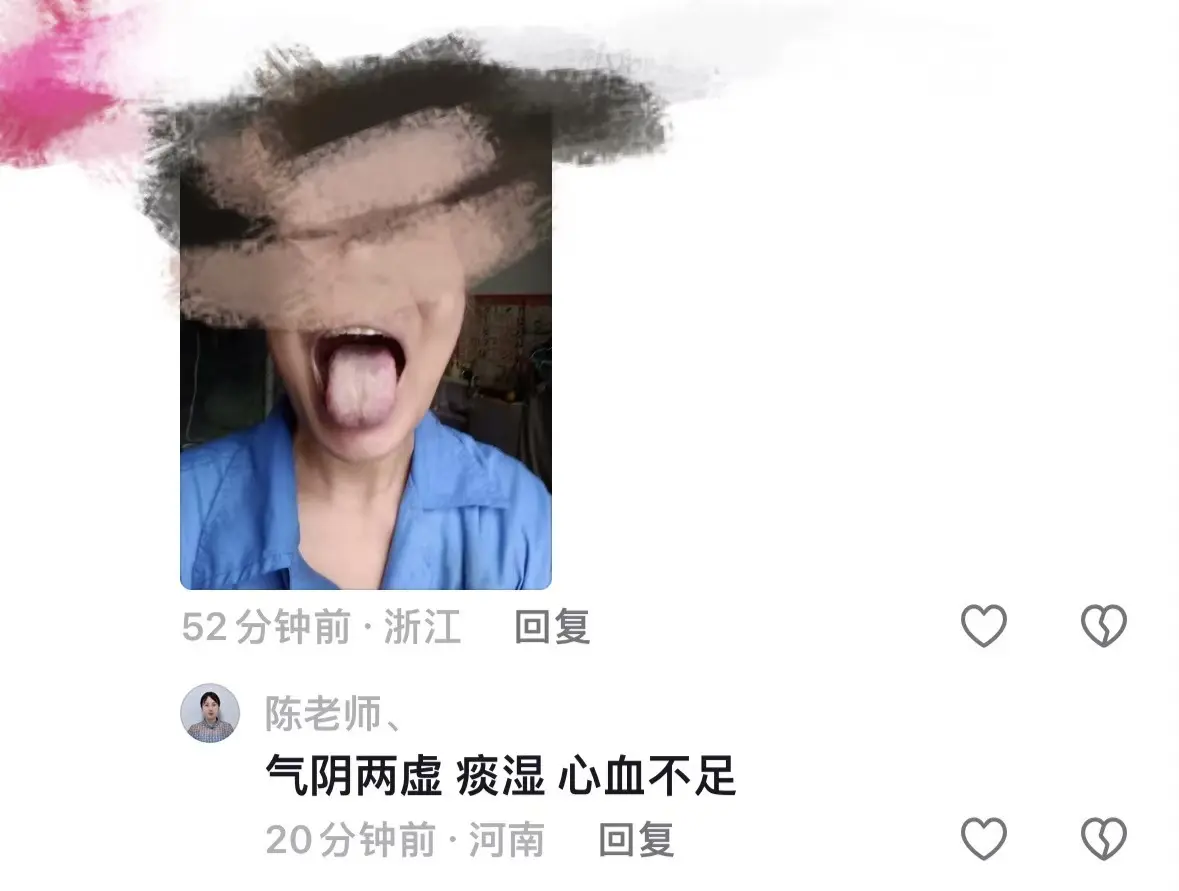 听从粉丝建议，抽空来辨证一下舌苔，先抽这3个的来看！ 1.有肝火，湿久...