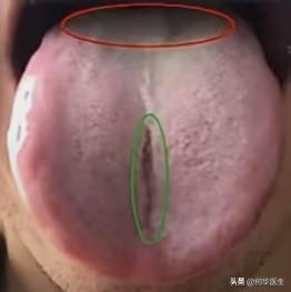 小伙子年纪不大，身体却虚成这样，一定要管住手！

之前有位年轻的男性患者前来看诊