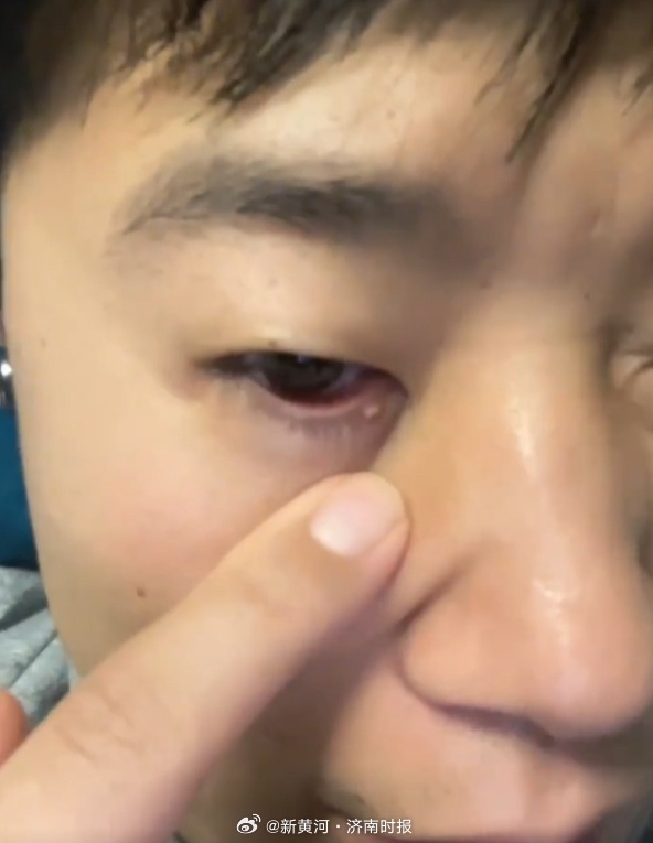 【#李越宏在印度感染后回应网友#】10月13日，正在印度新德里参加2024射击世