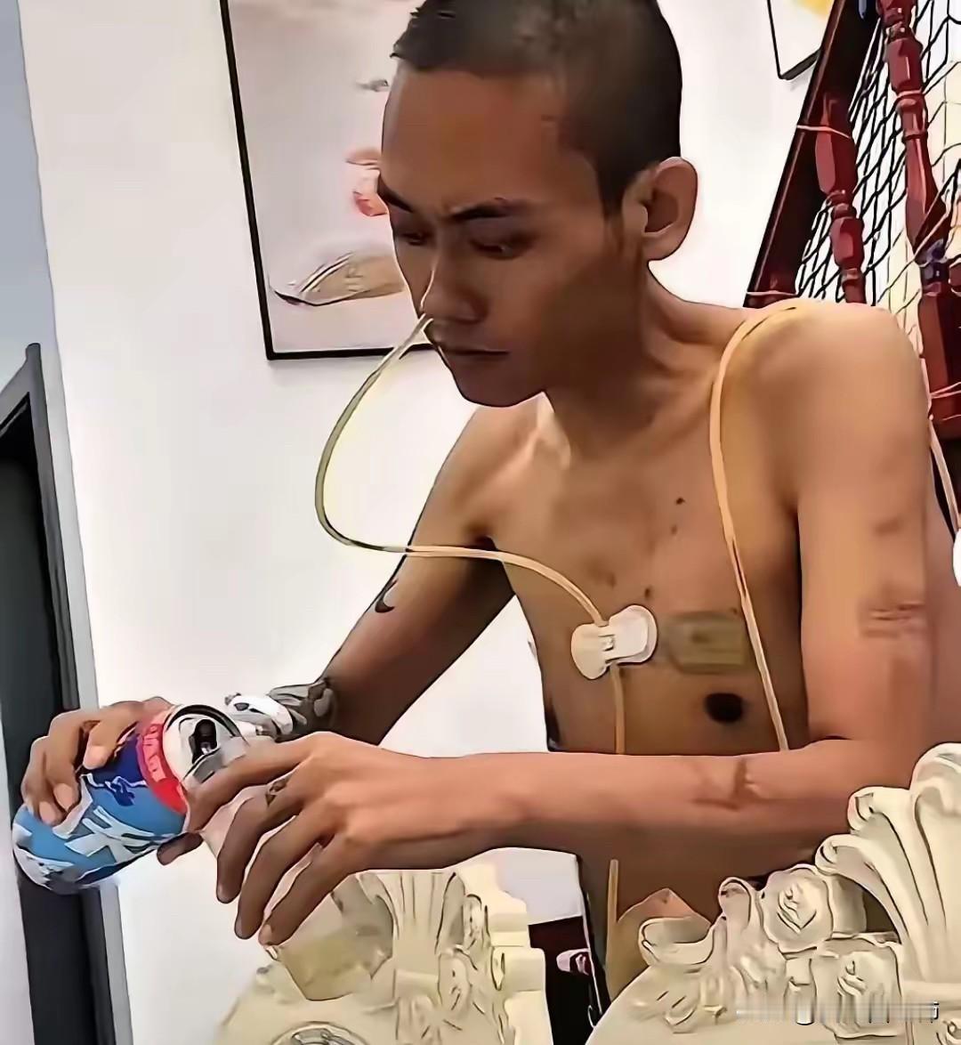 生死看淡！四川一男子患有肝癌晚期，放弃治疗后买了箱啤酒，他浑身插着管子，光着膀子