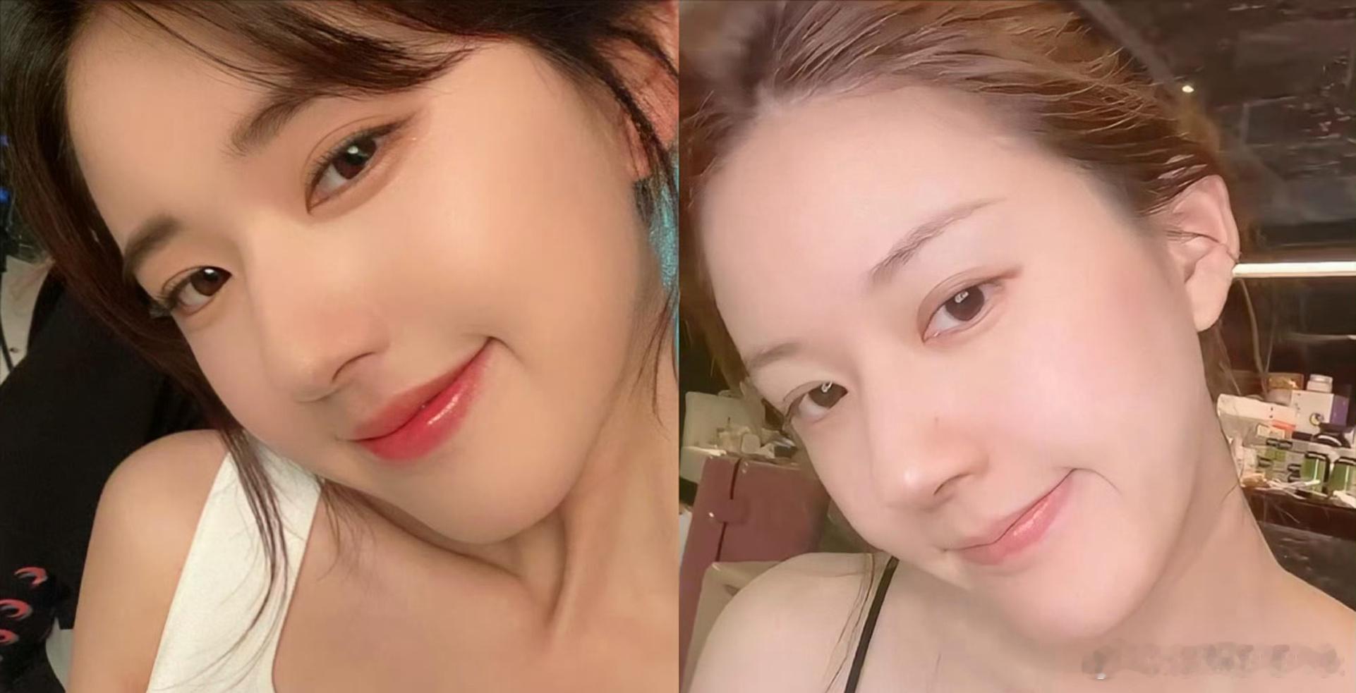 这么对比赵露思脸变化确实不大 ​​​