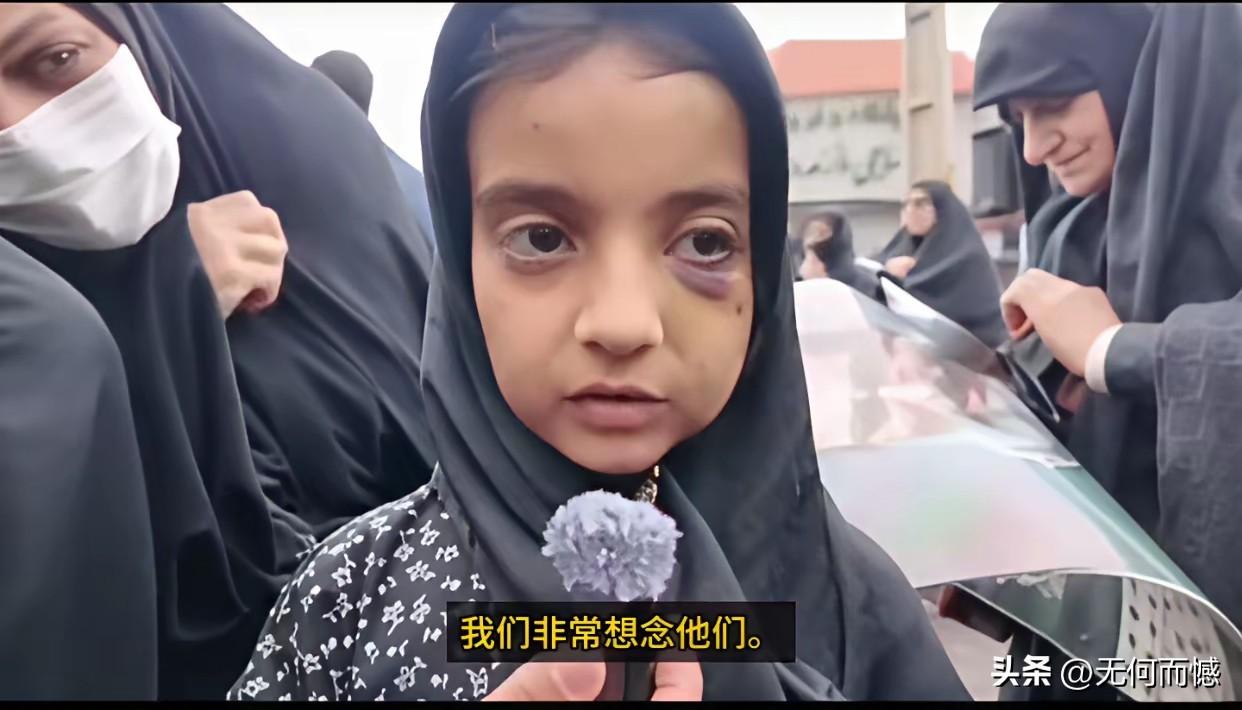 这个女孩是美军轰炸伊朗小学中的幸存者，在面对镜头的时候，脸上还有伤痕，她虽然死里