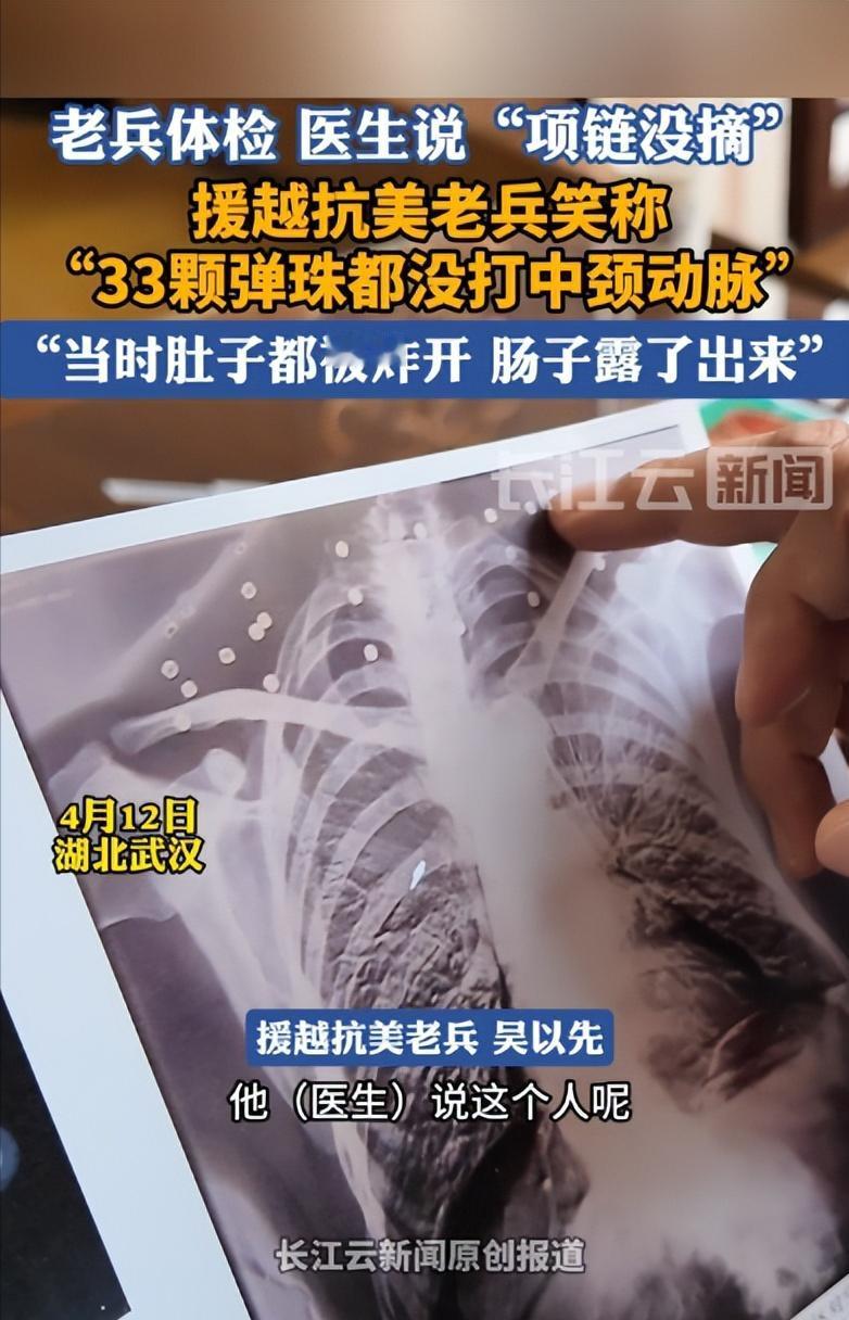 “这就是命啊！”4月12日，湖北武汉，一老人去医院做检查，医生看了CT报告单后，