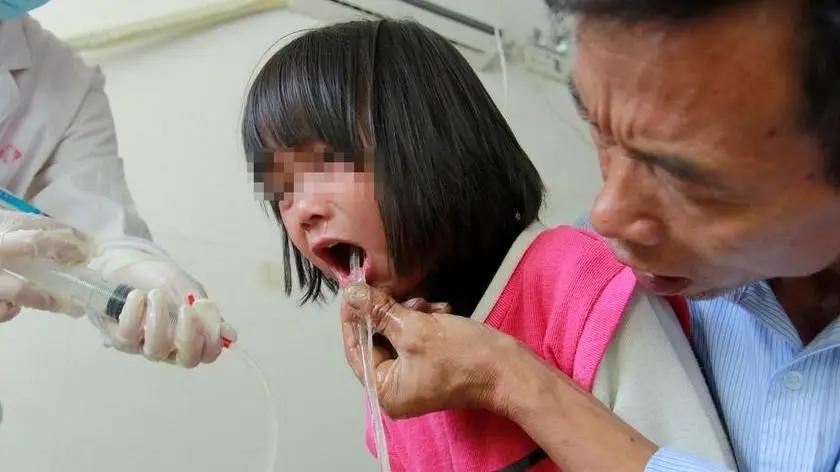 警惕！三种食物易致儿童铅中毒，医生呼吁少吃

铅中毒及其相关风险
什么是铅中毒？
