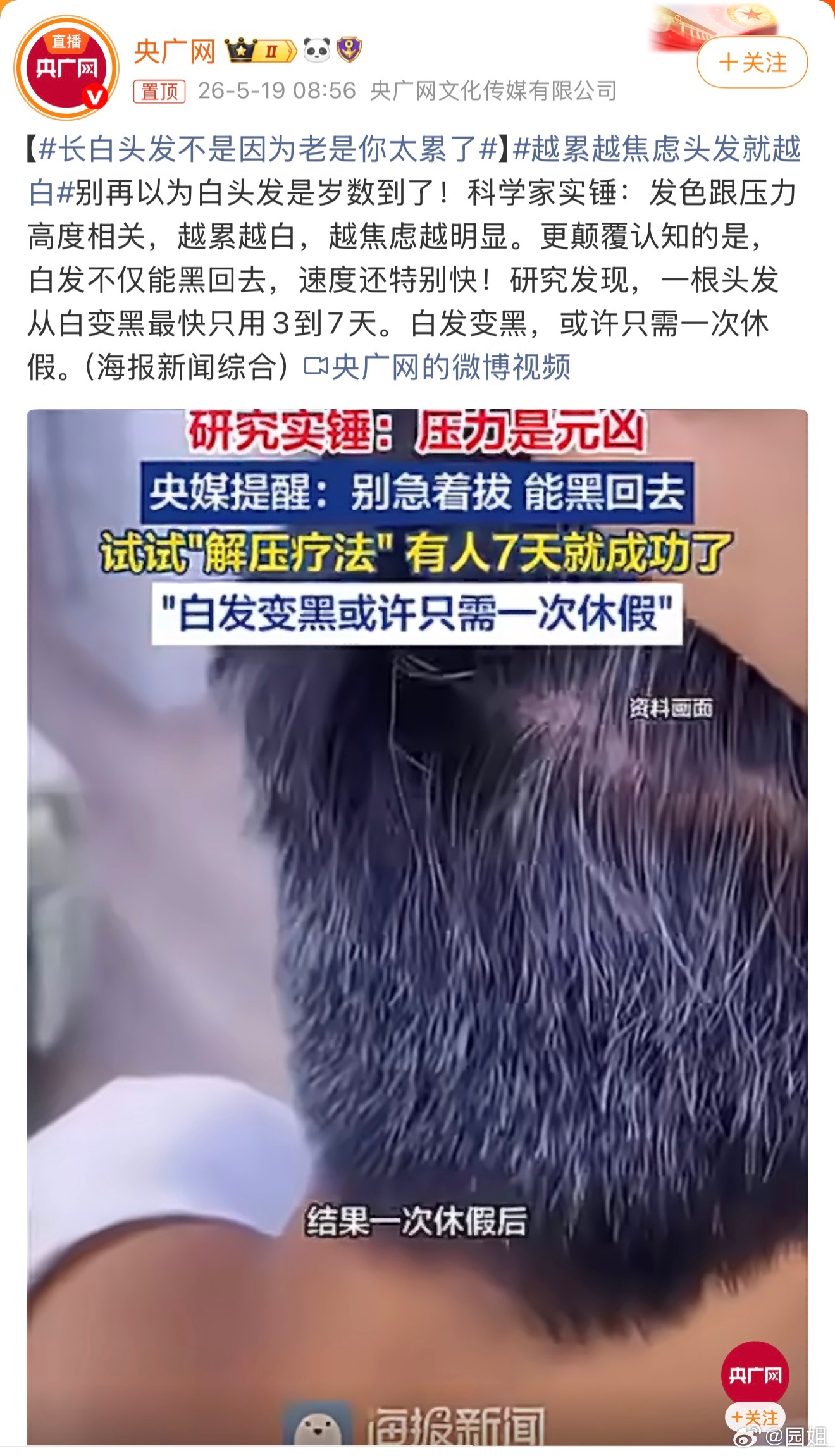 长白头发不是因为老是你太累了我觉得我就需要一次休假，我这两年也有一些白头发了，确