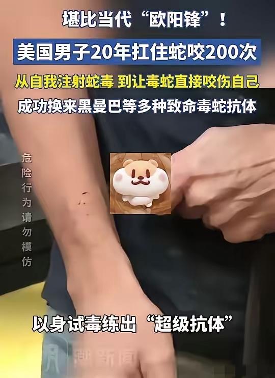 “活久见！”美国，一男子出于对毒蛇的好奇，开始少量注射蛇毒，并且慢慢加大剂量，最