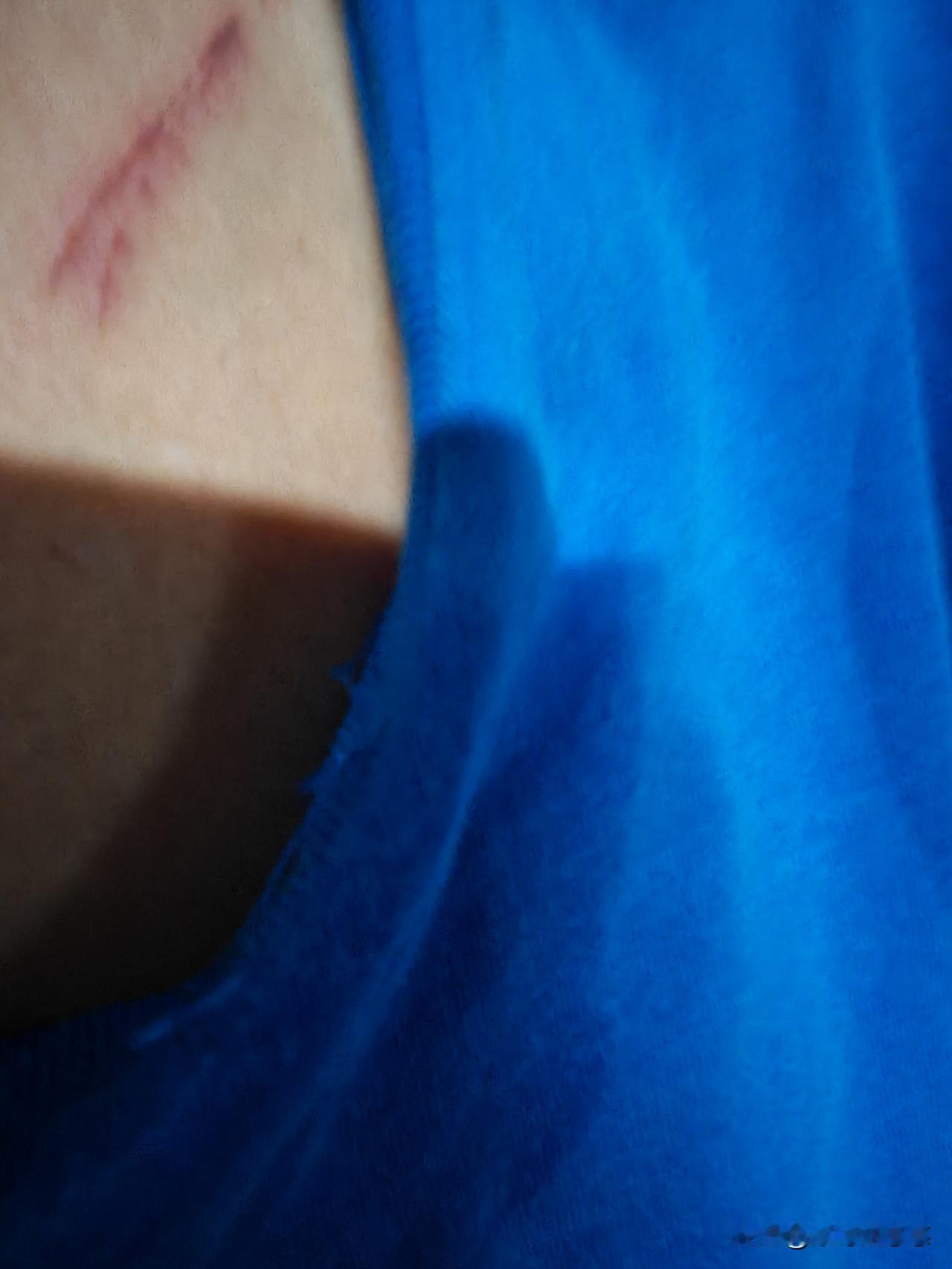 昨晚好睡，白天走累了，其实也不远，才13公里多，可能是太阳太大，加之又有上坡下坡