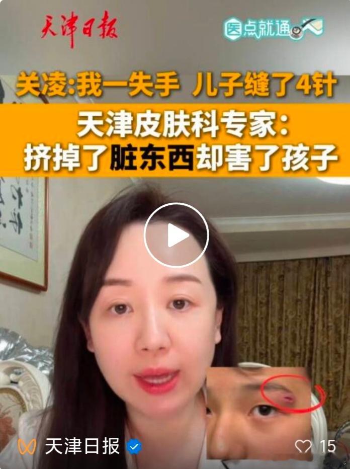 【关凌爆料自己一失手，儿子缝了4针！天津皮肤科专家：90%家长都在犯的致命错误】